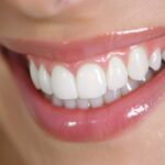 Thumbnail of post image 080